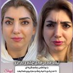 کلینیک زیبایی شایلی