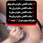 کلینیک لیزر و لاغری مبینا