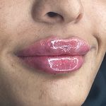 کلینیک پوست سلین - کلینیک پوست و مو - شهر شیراز - 0030