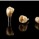 دندانسازی ابراهیمی