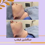 مرکز لیزر مرکز زیبایی دکتر مهسا رحیمی