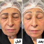 کلینیک تخصصی زیبایی فاین