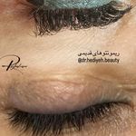 کلینیک زیبایی دکتر هدیه دهقانپور