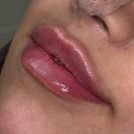 کلینیک زیبایی ولیزر دریا(کندلا آمریکایی)