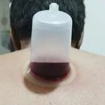 مرکز حجامت و طب سنتی دکتر رضا اثناعشری