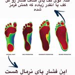 فیزیوتراپی معینی(قرارداد با بیمه ها)