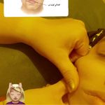 فیزیوتراپی معینی(قرارداد با بیمه ها)