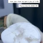 مژگان اسکین کرMojgan skincare