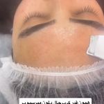 مژگان اسکین کرMojgan skincare