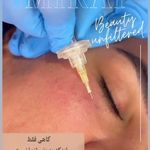 مژگان اسکین کرMojgan skincare