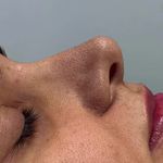 مژگان اسکین کرMojgan skincare