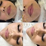 کلینیک زیبایی کاترین