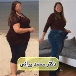 متخصص لاغری دکتر محمد یرانی(بیمه تکمیلی)