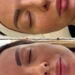 خدمات تخصصی پوست،فیشال،ماساژ سندی بانوان