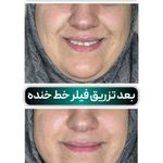 کلینیک درمانی زیبایی آینا