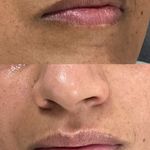 خدمات تخصصي پوست و تيرگي هاي بدن محبوبه