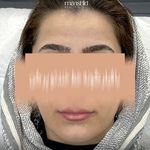 کلینیک زیبایی مانشید