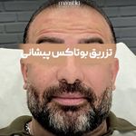 کلینیک زیبایی مانشید