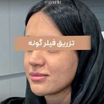کلینیک زیبایی مانشید
