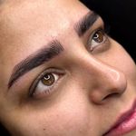 میکروبلیدینگ فیبروز تخصصی