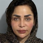 کلینیک زیبایی کاترین