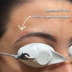 کیلینیک زیبایی و لیزر ژامک