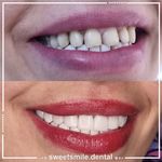 مطب دندان پزشکی لبخند شیرین