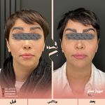 مرکز پزشکی و زیبایی میروژ سنتر