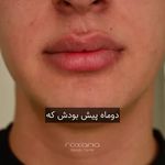 کلینیک پوست مو و زیبایی رکسانا