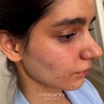 کلینیک پوست مو و زیبایی رکسانا