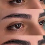 میکروبلیدینگ میناسلمانی