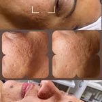 فیشیال و پاکسازی تخصصی ندا دمیرچی