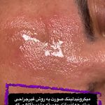 فیشیال و پاکسازی تخصصی ندا دمیرچی