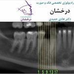 کلینیک رادیولوژی فک و صورت درخشان