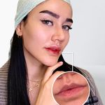 مرکز زیبایی لوسین