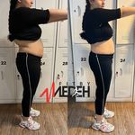 ایکسبادی - ای ام اس (EMS) پیروزی