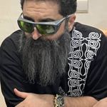 مطب ایمپلنت