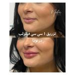 کلینیک زیبایی و لیزر مو زائد نوبا