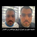 مرکز پوست،مو وزیبایی دکتر فرنوش میلانی