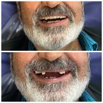 مجموعه دندان پزشکی و دندان سازی نچرال