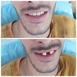 مجموعه دندان پزشکی و دندان سازی نچرال