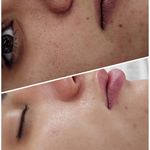 فیشیال / خدمات پوست / سالن زیبایی