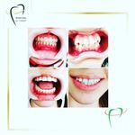 مركز دندانپزشکی دکترفرنوش عیوضی