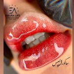 مرکز تخصصی میکرو بلیدینگ شبنم عابدی
