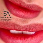 مرکز تخصصی میکرو بلیدینگ شبنم عابدی