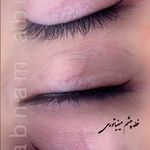 مرکز تخصصی میکرو بلیدینگ شبنم عابدی