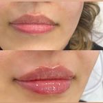 مطب زیبایی خانم محمدرضایی پوست ومو