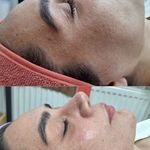 فیشال و خدمات پاکسازی پوست  فاطمه انامی