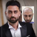 کلینیک پوست مو و زیبایی نوین ایرانا