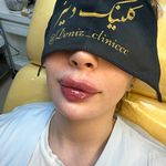 کلینیک لیزر و زیبایی دنیز